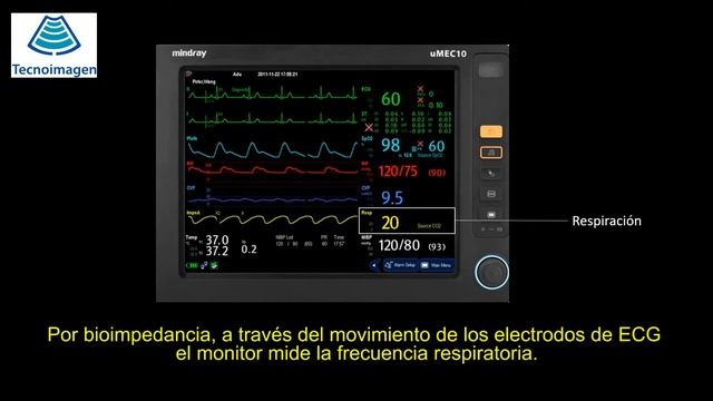 Guía de operación del monitor de paciente serie uMEC смотреть онлайн
