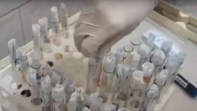 Причины заболевания раком 2016 смотреть онлайн