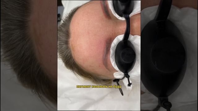 Удаление некачественного татуажа бровей (перманентного макияжа) в Самаре смотреть онлайн