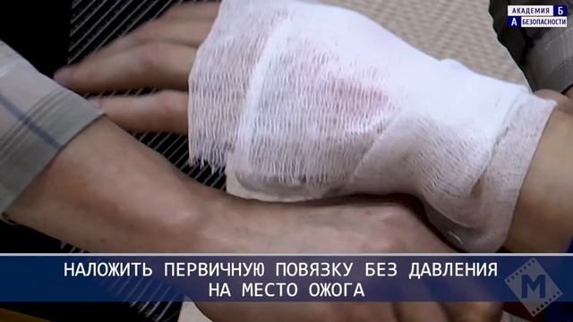 Местное охлаждение и наложение первичной повязки при термических ожогах смотреть онлайн