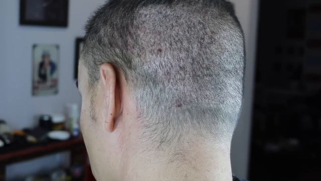 CORTE DE PELO TRAS UN TRASPLANTE DE PELO: Pautas para el corte de pelo смотреть онлайн