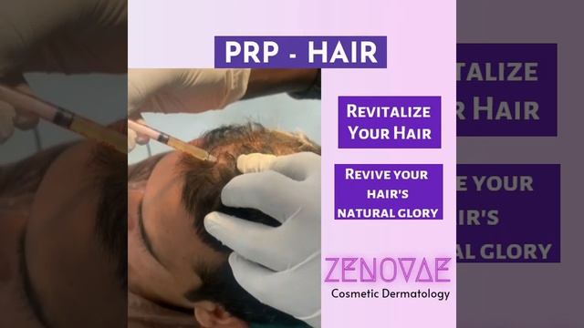 ZENOVAE (Skin Rejuvenation, PRP- Hair & Face) смотреть онлайн