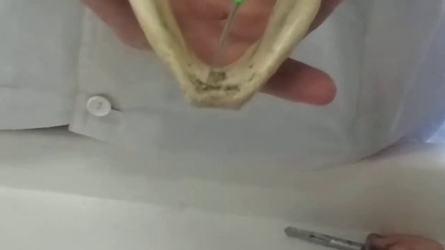 Кости лицевого черепа(7)