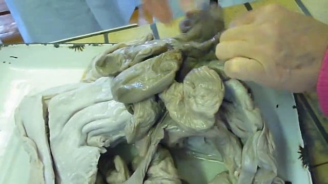 Яичники, матка смотреть онлайн