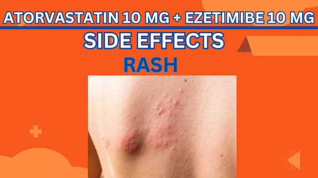 ezetimibe/ zetia/ezetimibe 10 mg/ Atorvastatin 10 mg ezetimibe 10 mg смотреть онлайн