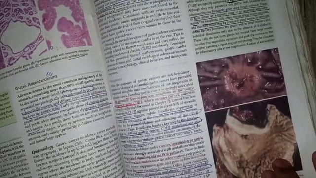 important topics of GIT revision смотреть онлайн