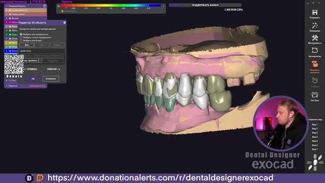 Exocad Stream / Reditive Compensation / VoxelDance Additive / HTML to STL/ Разбор работ смотреть онлайн