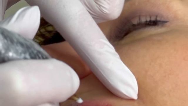 Процедура видалення татуаж губ ремувером Revivink ? смотреть онлайн