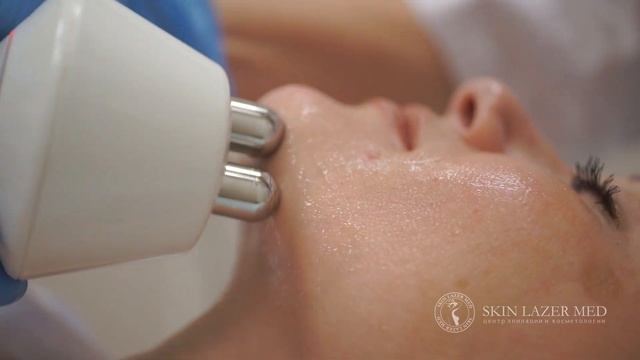 RF лифтинг лица. РФ лифтинг. Радиоволновой лифтинг смотреть онлайн