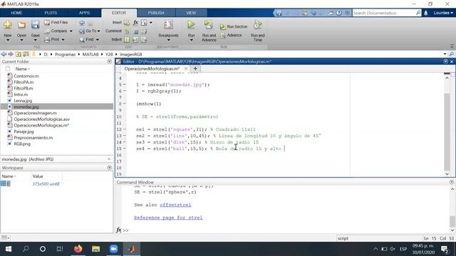 OPERACIONES MORFOLÓGICAS en MATLAB -DILATACIÓN y EROSIÓN -CURSO PROCESAMIENTO DE IMÁGENES (PARTE 7) смотреть онлайн