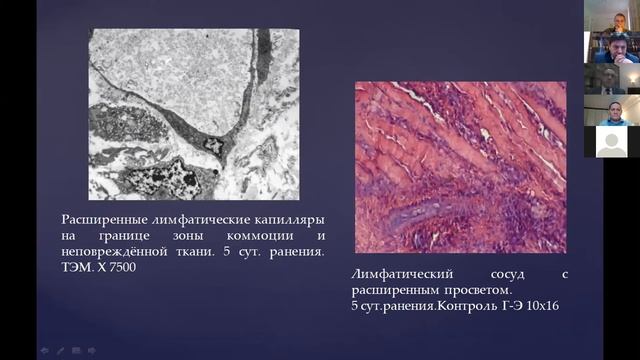 Джумабаев. Региональная лимфатическая терапия в хирургии быстрой реабилитации огнестрельных ранений смотреть онлайн