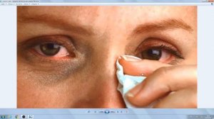 Слезятся и чешутся глаза!