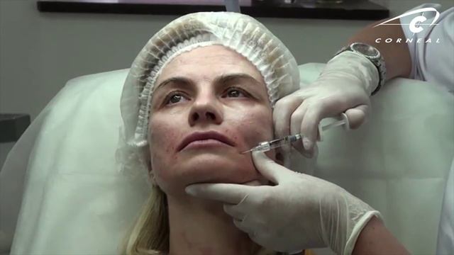 Кисет - коррекция капельной техникой смотреть онлайн