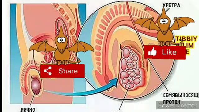 Erkakalar Uchun 6 Ta Havfli Kasallik.Erkaklar Salomatligiga Ta'sir Qiluvchi Kasalliklar