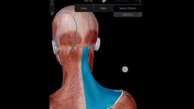 Хронические головные боли.  3D разбор