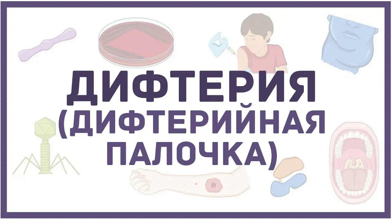 Дифтерия - C. diphtheriae (дифтерийная палочка), причины, симптомы, диагностика, лечение смотреть онлайн