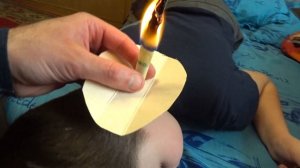 Отит у ребенка. Серная пробка в ухе. Народная медицина