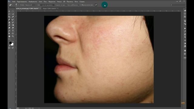 Инструменты ретуши. Инструмент Точечная восстанавливающая кисть. Учимся убирать прыщи. смотреть онлайн