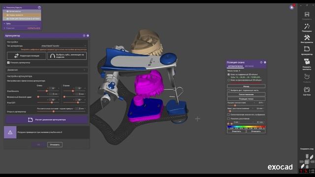 Artex-Fobos-Transfer смотреть онлайн