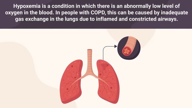 Top Early Warning Signs of COPD *MUST KNOW* ⚠️ смотреть онлайн