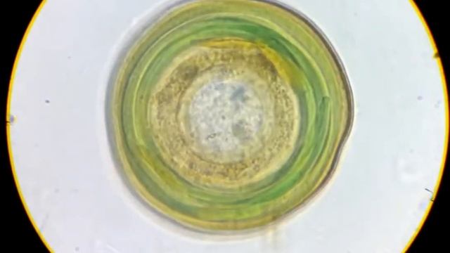 Цианеи внутри раковинной амебы.Ускорено 8х Cyanobacteria crawled inside the amoeba.Speed 8х смотреть онлайн