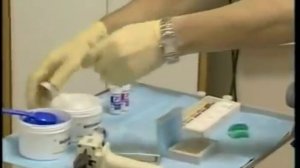 Препарирование под металлокерамическую коронку