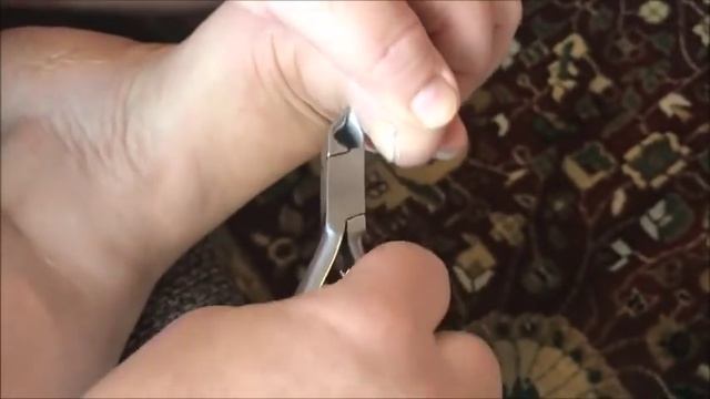 Вросший Ноготь, как удалить самому . смотреть онлайн