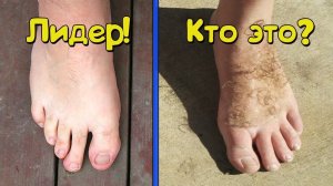 Как у тебя выглядят ПАЛЬЦЫ НА НОГАХ! Узнай кто ты!