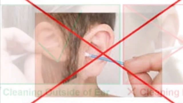 как правильно чистить уши ? How to clean your ear in 10 sec) Dr.Mathieu смотреть онлайн