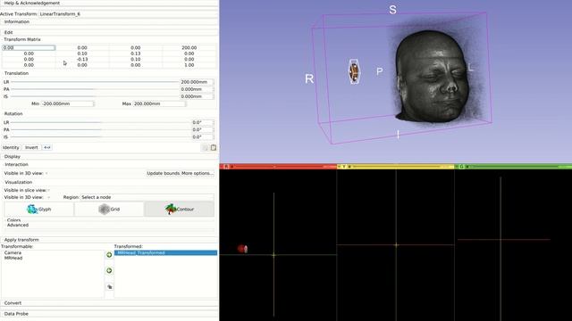Slicer 2020 04 Applying a transform смотреть онлайн