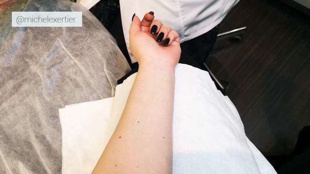 Фотоомоложение: процедура на аппарате «IPL» смотреть онлайн