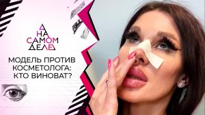 Обезображенная модель разоблачает элитного косметолога. На самом деле. Выпуск от 16.05.2021