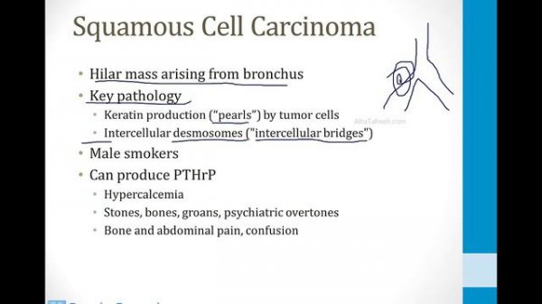 Pulmonary - 3. Other Pulmonary Topics - 3.Lung Cancer atf