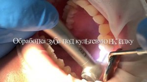 Извлечение Штифта