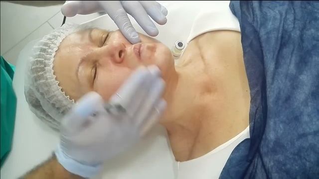 Peeling chimico PRX-T33 смотреть онлайн