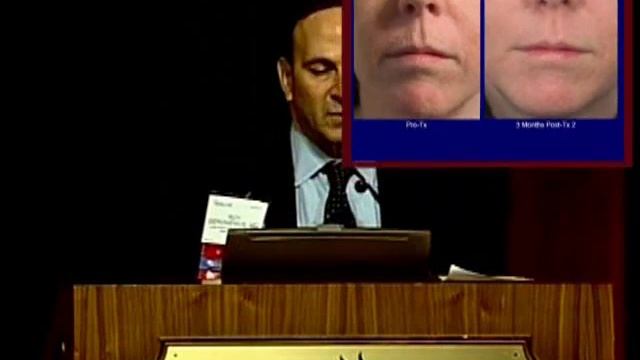 Fractional Deep Dermal Ablation Laser Resurfacing смотреть онлайн