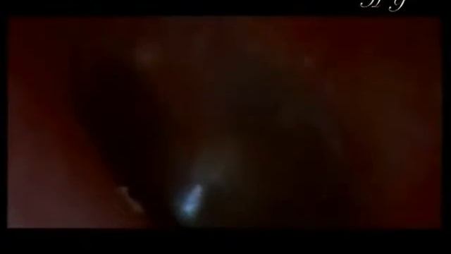 Чудо слуха смотреть онлайн