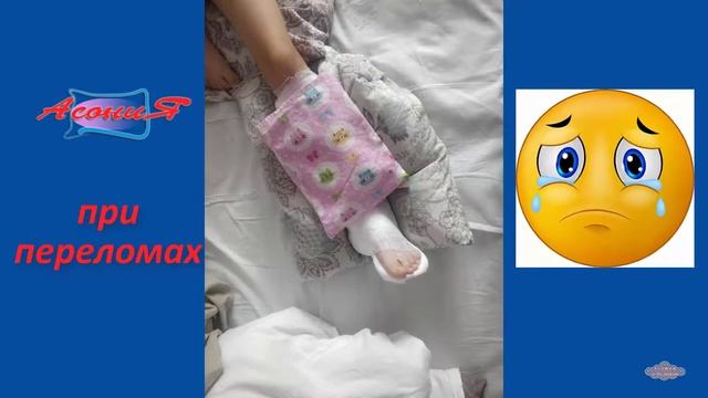 Асония при переломах Отзыв Татьяны из Новокузнецка смотреть онлайн