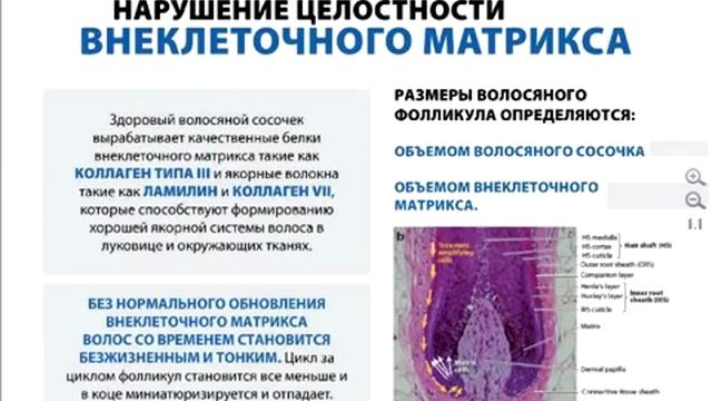 На рынок выходит уникальное средство от облысения! смотреть онлайн