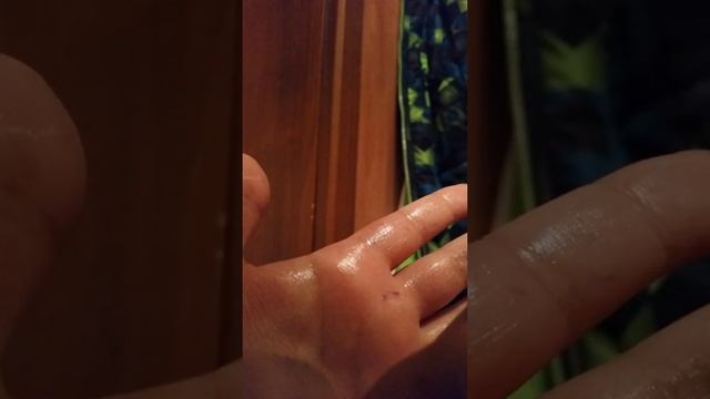 У меня слезает кожа смотреть онлайн