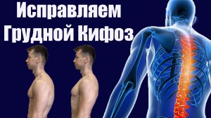 Как исправить грудной кифоз, упражнения для спины дома
