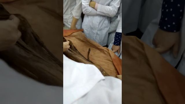 Пояснично-крестцовое сплетение (1) смотреть онлайн