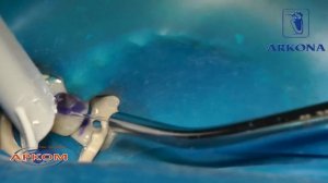 Штифт в зубе