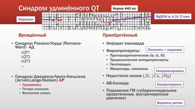Аритмии. Каналопатии: синдром Бругада и удлинённого QT смотреть онлайн