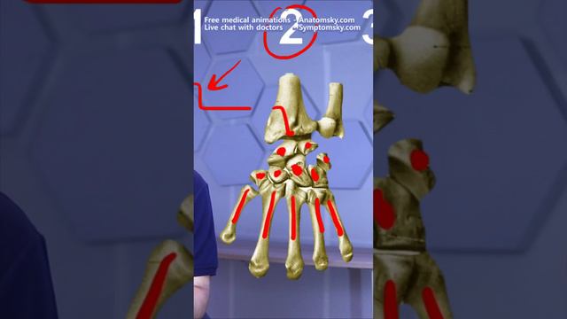 3 Reasons For a Surgery of Radius! смотреть онлайн