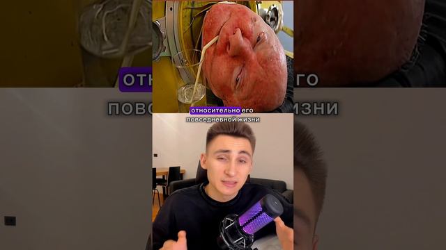 Человек с железными легкими смотреть онлайн