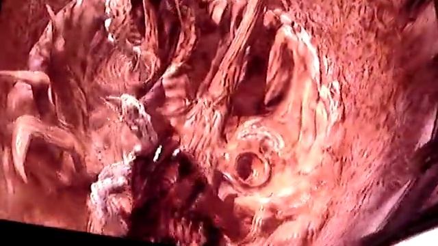 Dead Space - Chapter 6 Part 7 (Leviathan boss fight) смотреть онлайн