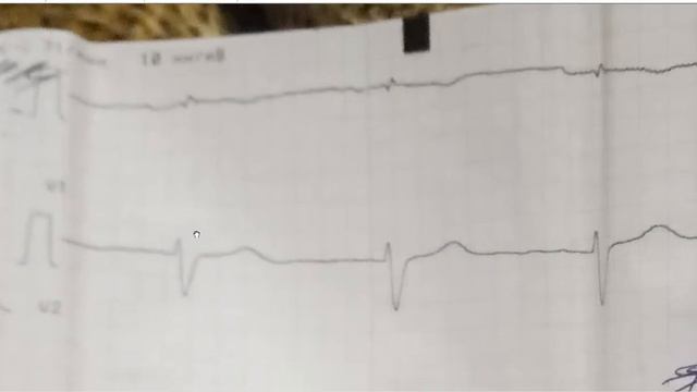 Запись 2020 05 30 19 13 10 436 смотреть онлайн