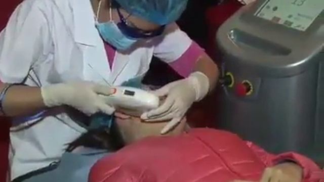 FDA approved IPL SHR hair removal device смотреть онлайн