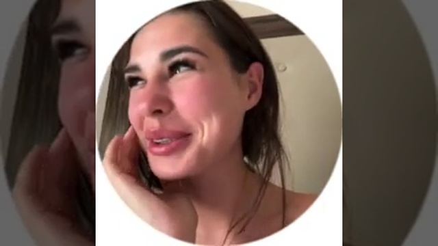 ОПУХШАЯ И КРАСНАЯ ИРИНА ПИНЧУК ? смотреть онлайн